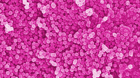  Nanoplastiques : particules de l'ordre du nanomètre (image de microscopie électronique, colorée, 50.000x). Image: Empa / ETH 