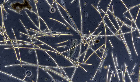 Warming of lakes reduces interactions in plankton networks – in the picture a microscope image is shown of a plankton community from Lake Greifen. (Photo: Marta Reyes, Eawag). 