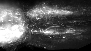  Visualisierung von regenerierenden Projektionen im gesamten Rückenmark. EPFL / .Neurorestore 