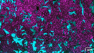 Bacteria. Image: Glen Dsouza